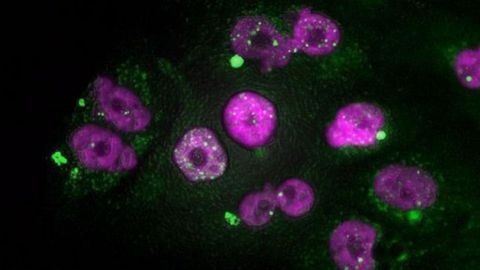 Preventing Aggressive Tumors From Becoming Resistant to Chemotherapy
