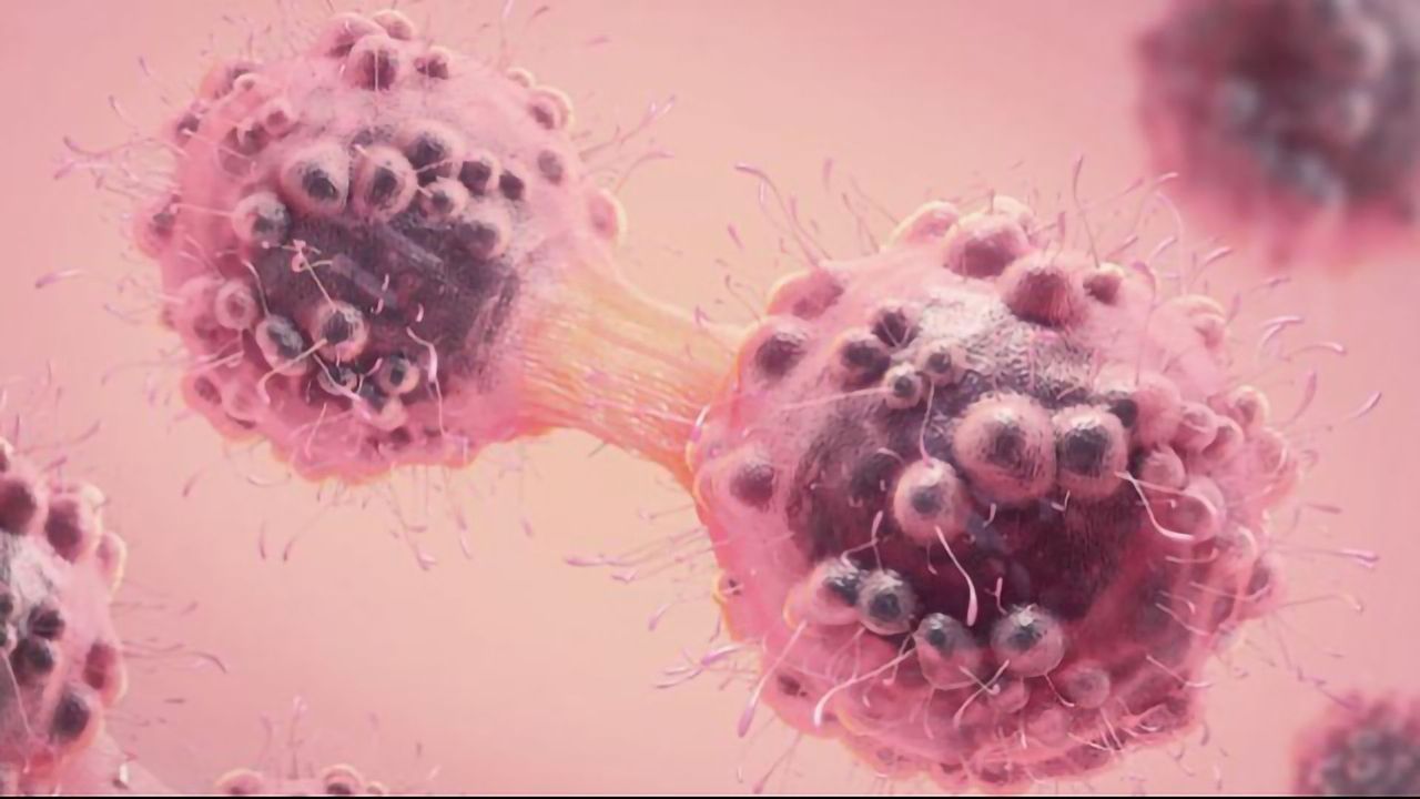 Breast and Kidney Cancer Drug Could Also Help Patients With Advanced Head and Neck Cancer