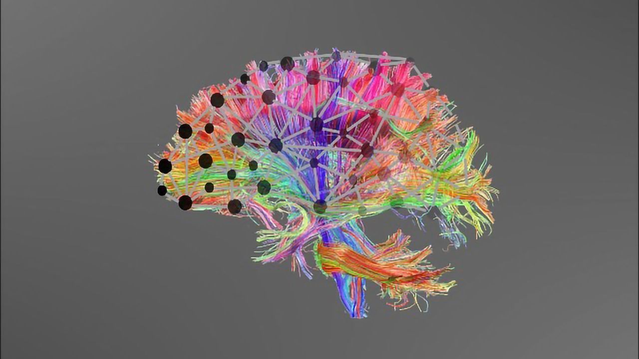 Could Poor Brain Connectivity Explain Learning Difficulties?