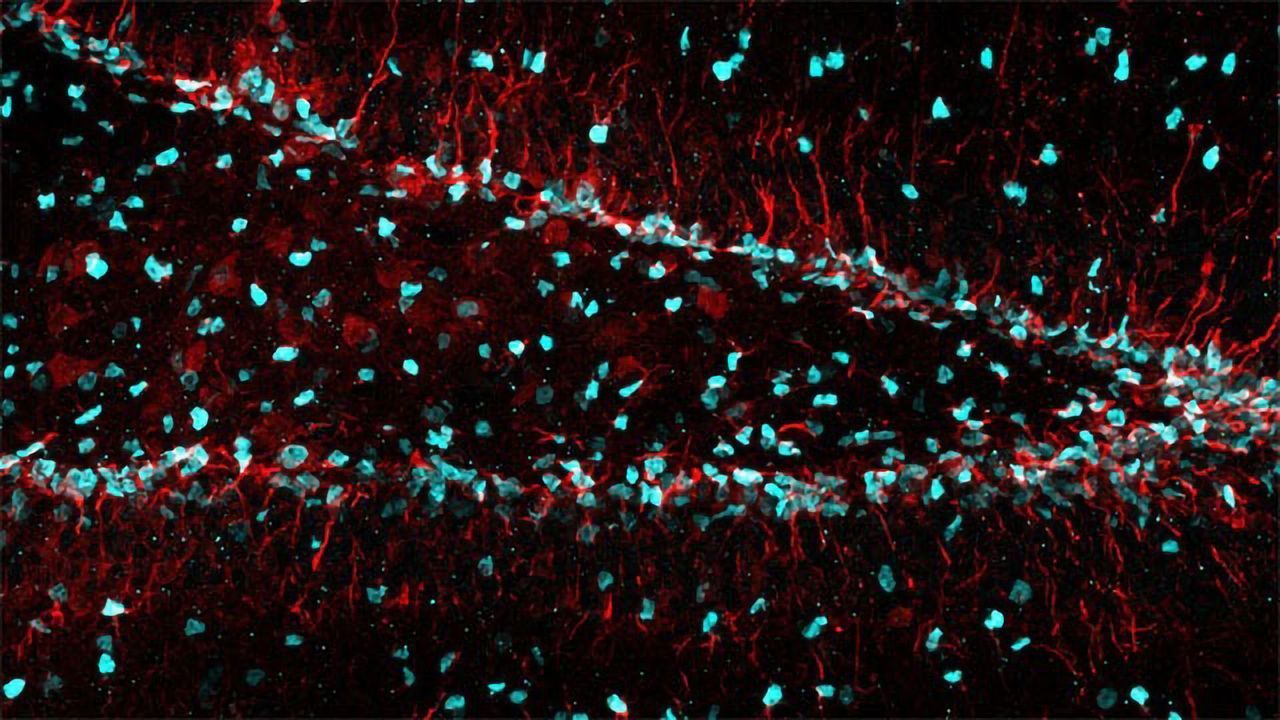 The Dentate Gyrus: Home to Neural Stem Cells