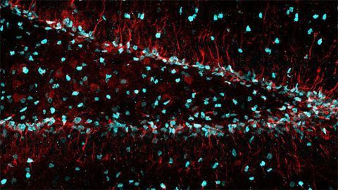 The Dentate Gyrus: Home to Neural Stem Cells