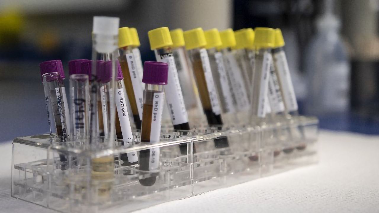 FDA Issues New Policy To Help Expedite Availability of Coronavirus Diagnostics