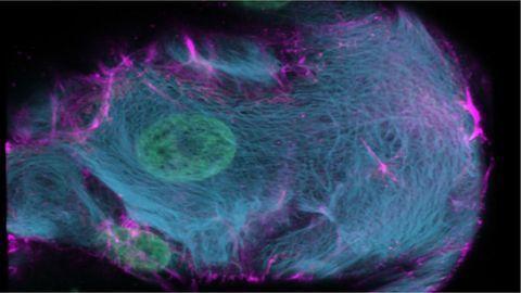 Coloring In With CRISPR