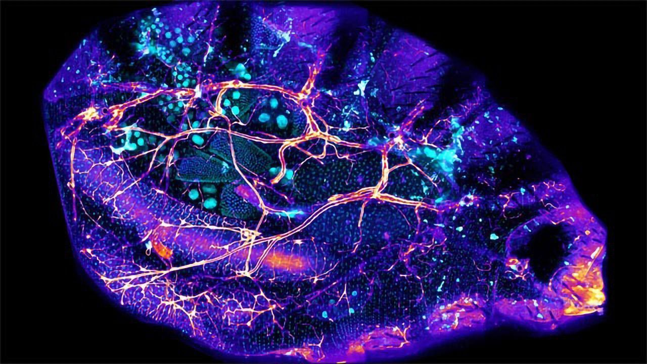 New Technique for Looking Inside Fruit Flies