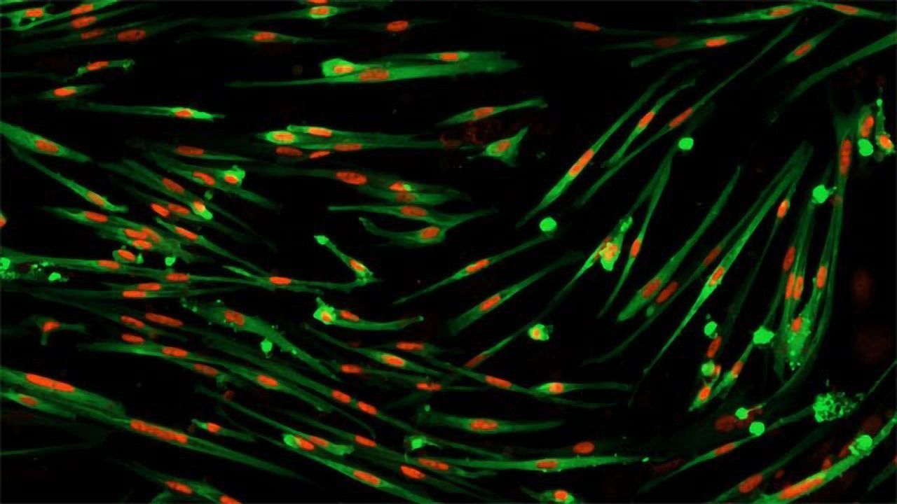 Simplifying Muscle Cell Generation