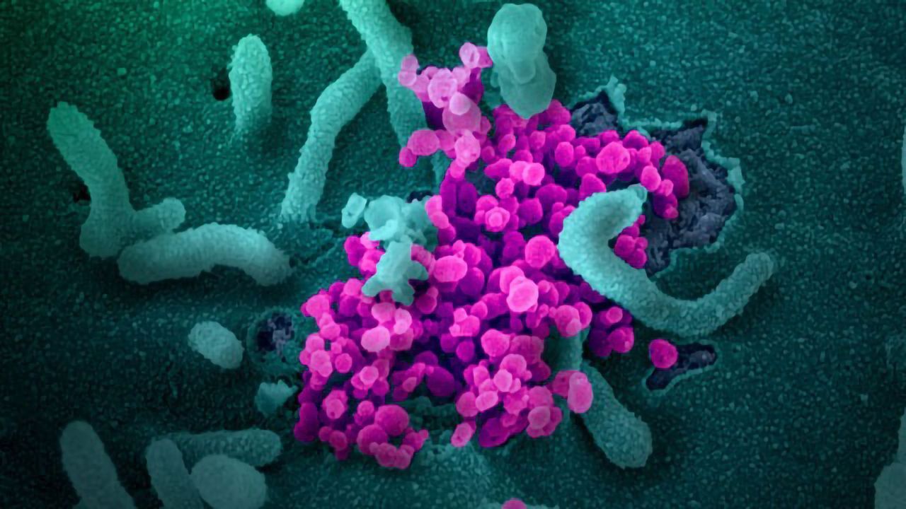 Structural Biology Helps Drive Coronavirus Vaccine Development