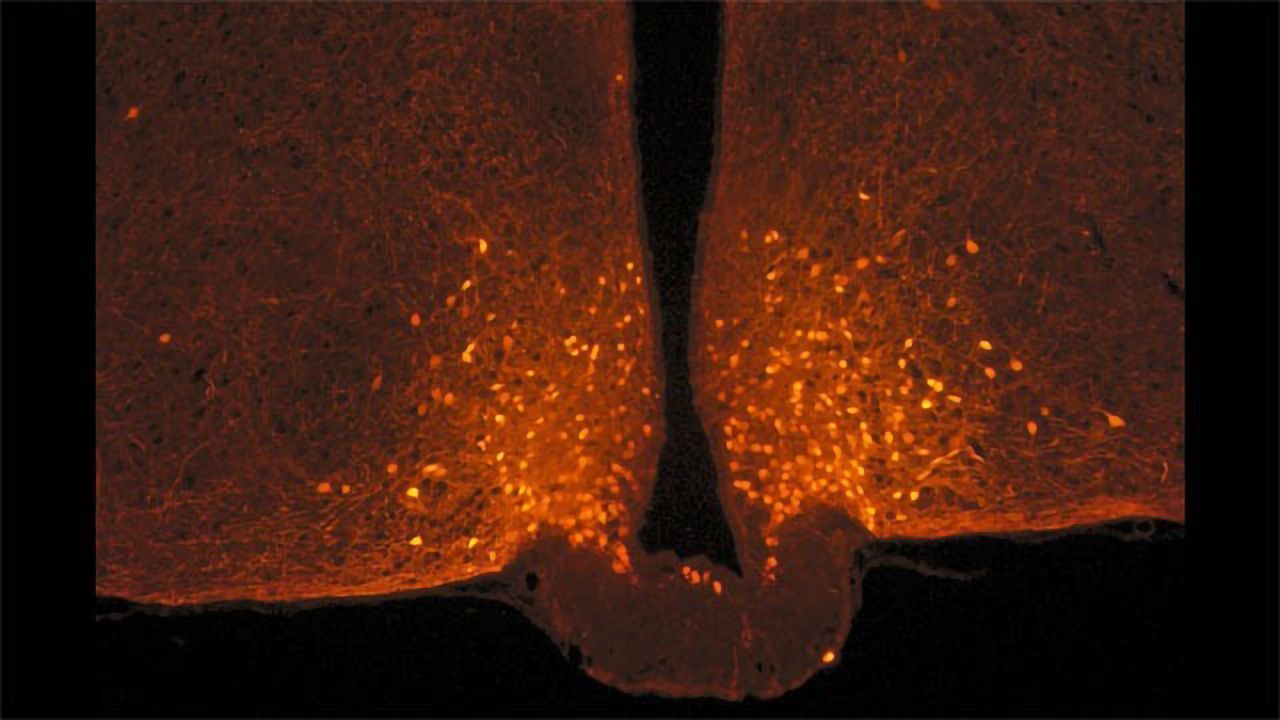 The Shape-changing Brain Cells at the Origin of Satiety