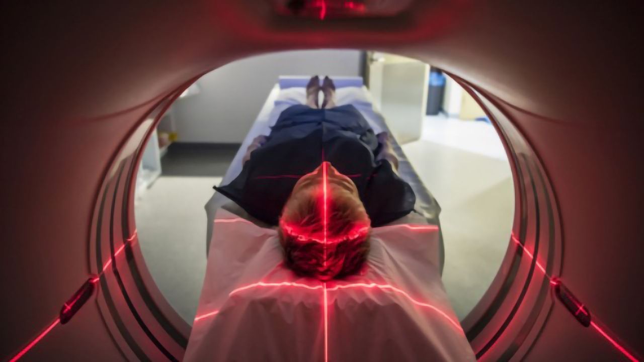 How Do Concussions Affect the Brain?