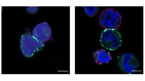Map of Proteins and Their Nearest Neighbors Illuminates Path to Cancer Drugs