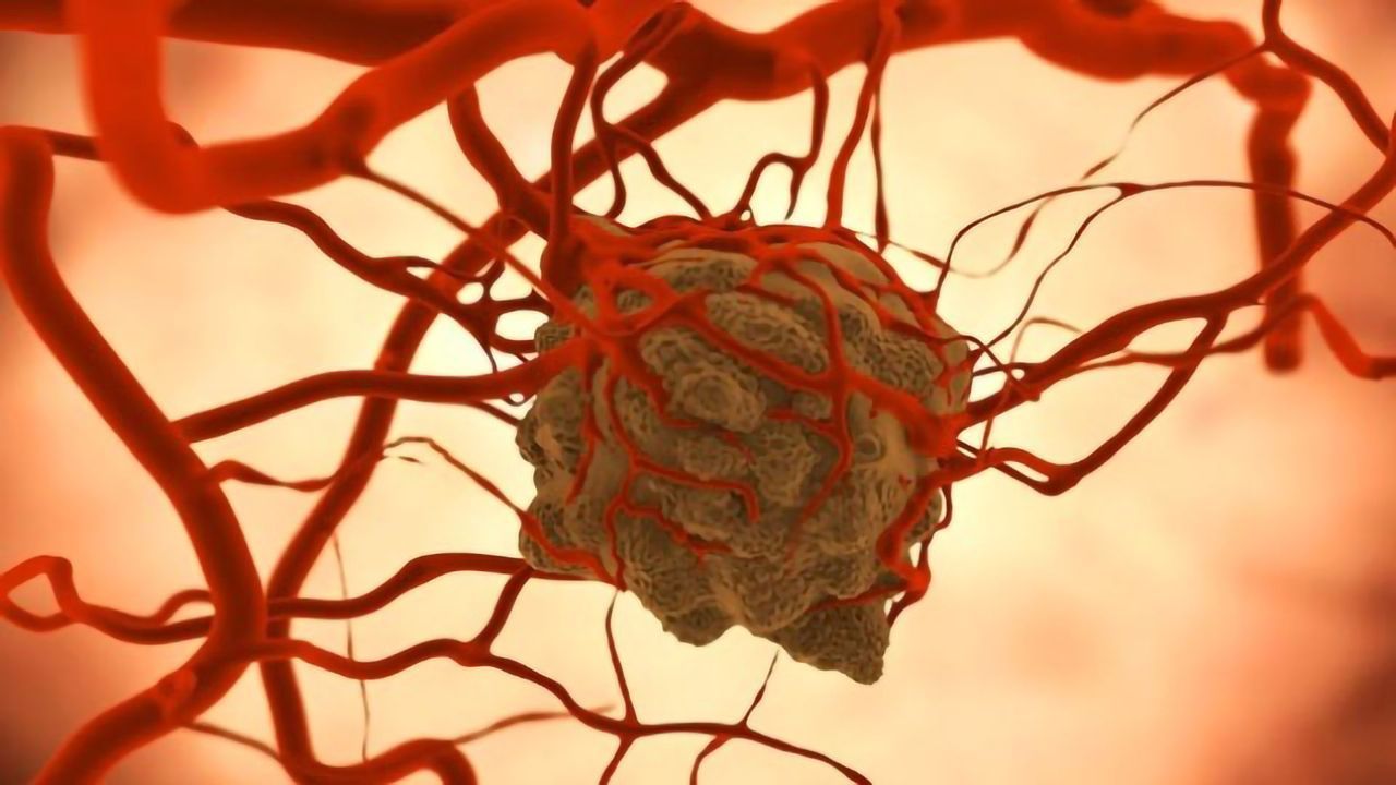 Gut Bacteria Can Accumulate in Tumors and Aid Immunotherapy Response