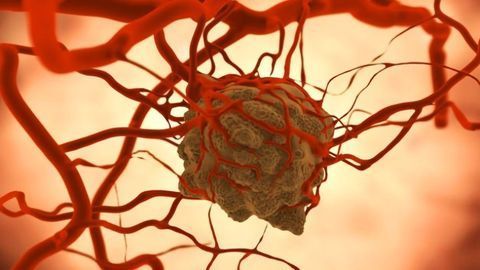 Gut Bacteria Can Accumulate in Tumors and Aid Immunotherapy Response