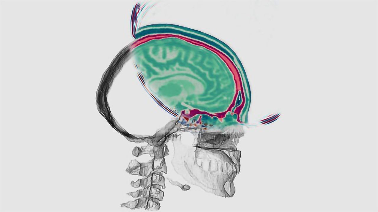 Seismic Technology Could Help Us See Inside the Brain