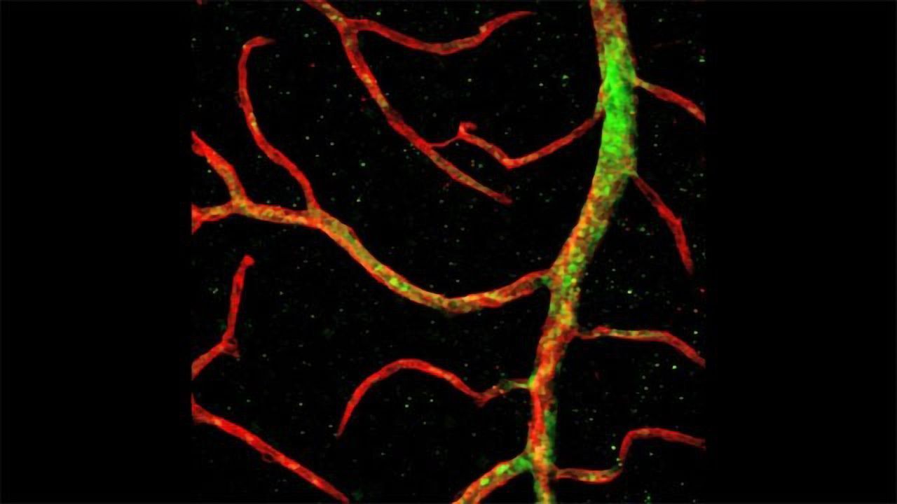 Human Vascular Progenitor Cells