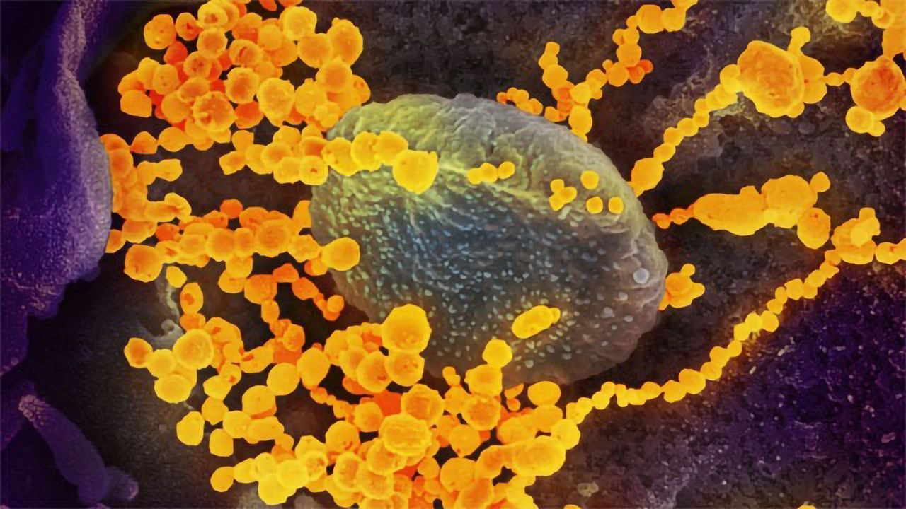 Novel Coronavirus: 2019-nCoV