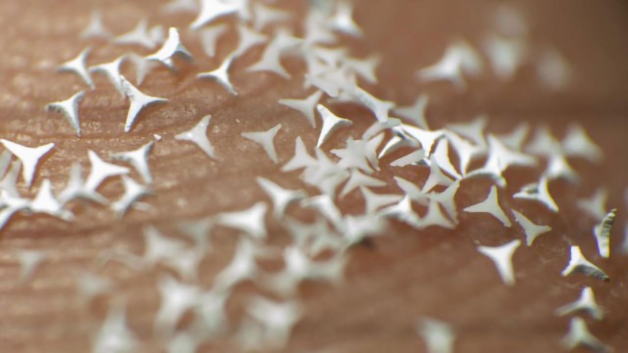 Microscopic STAR Particles – A New Treatment Option for Skin Diseases?