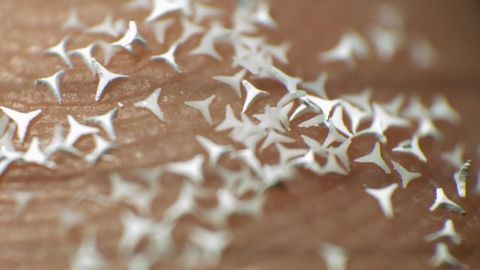 Microscopic STAR Particles – A New Treatment Option for Skin Diseases?