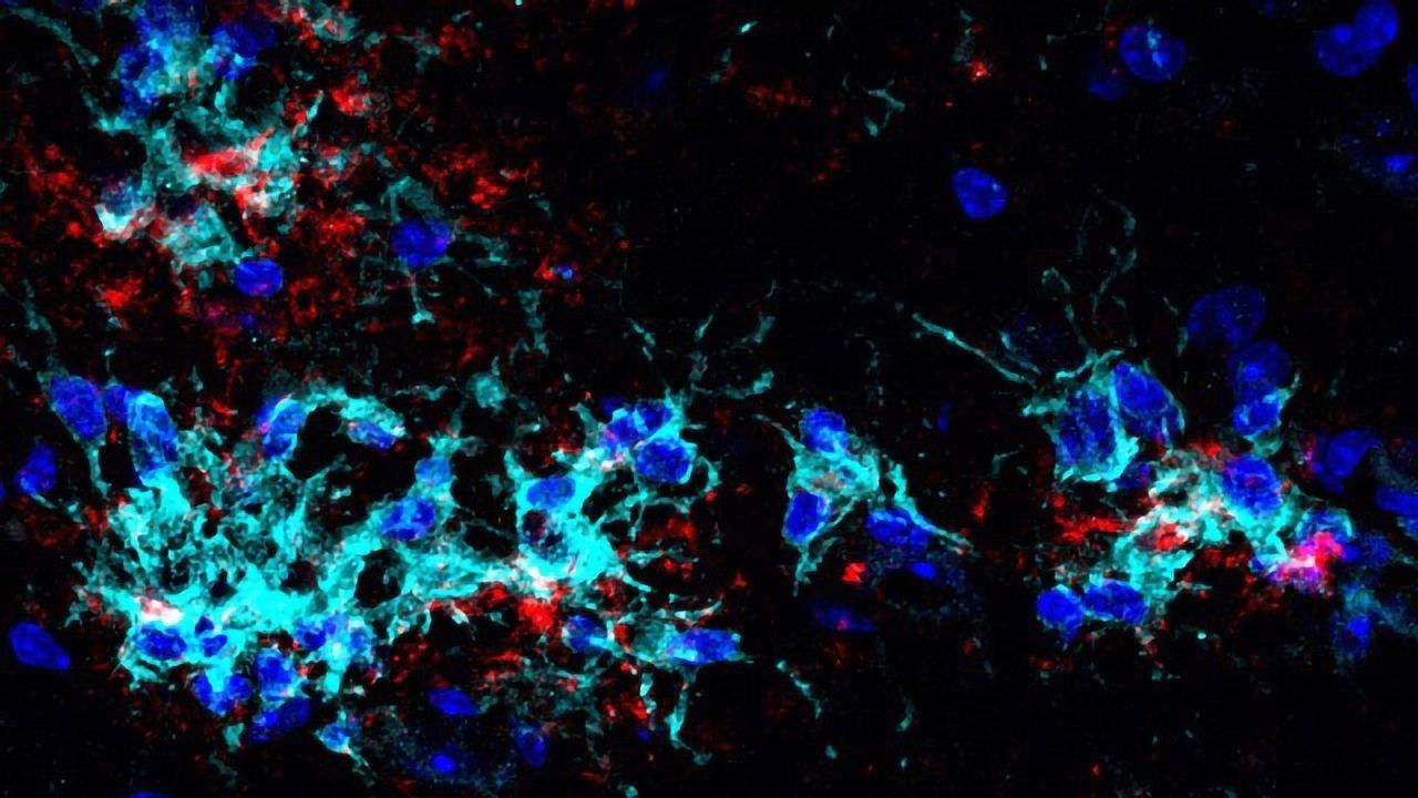Immune Cells Against Alzheimer's'?