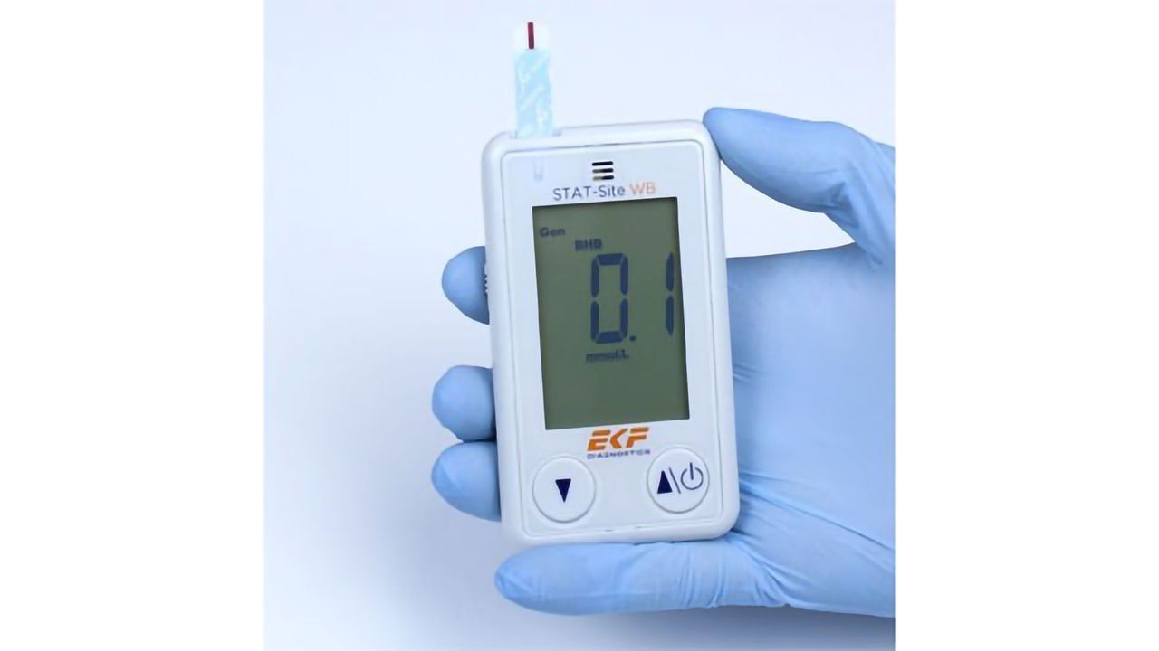 EKF Launches Point-of-care β-ketone and Glucose Analyzer in US