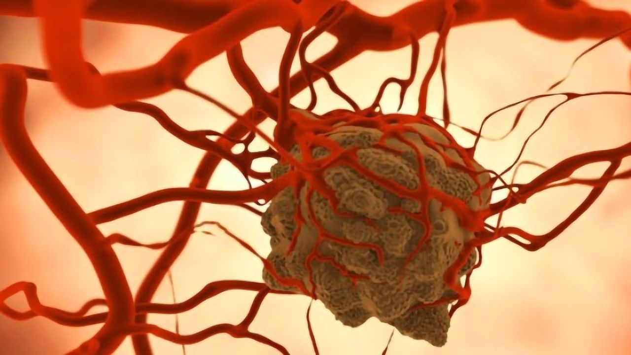 The Immune System Attacks Tumors Remotely