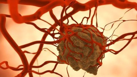 The Immune System Attacks Tumors Remotely