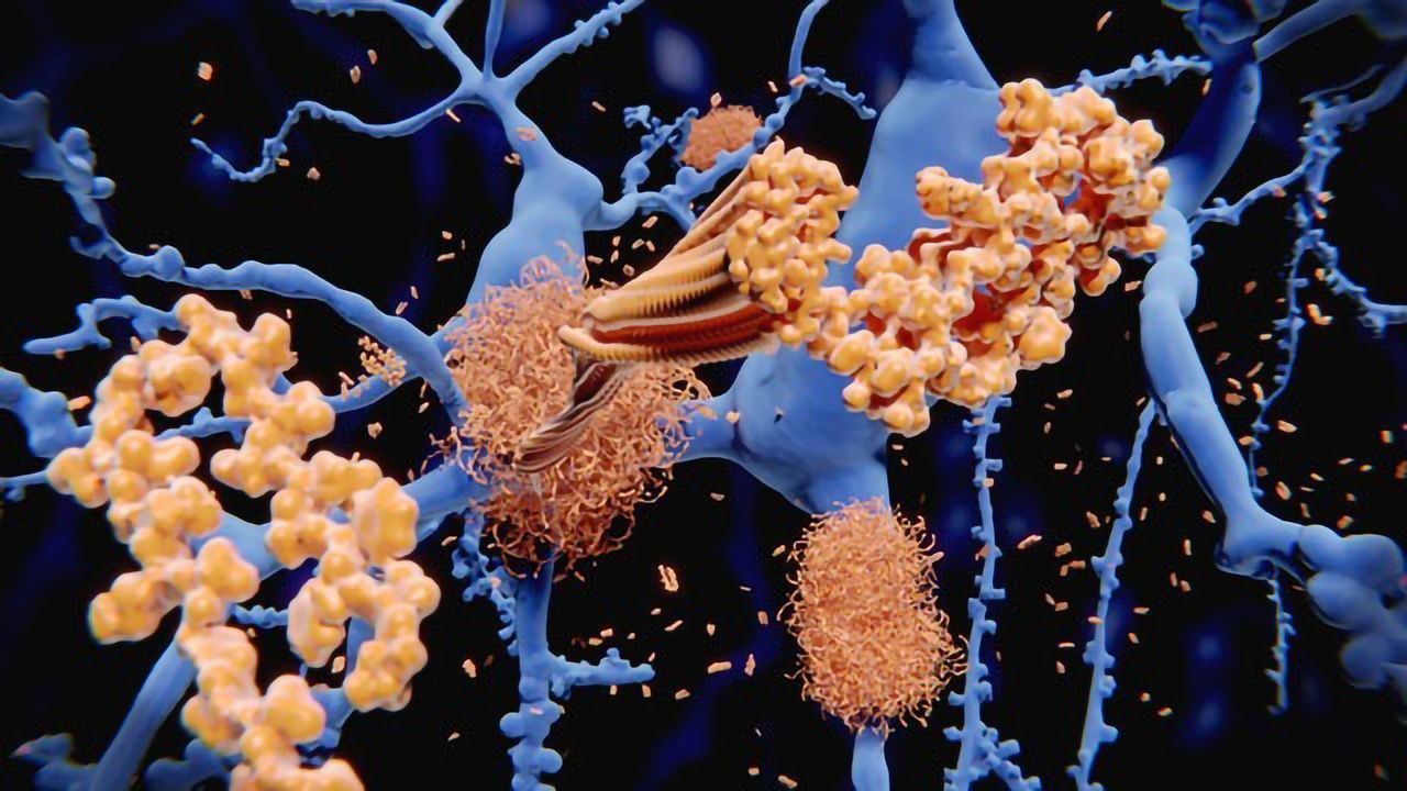 Researchers Target Amyloid Fibrils With Gold Nanoparticles