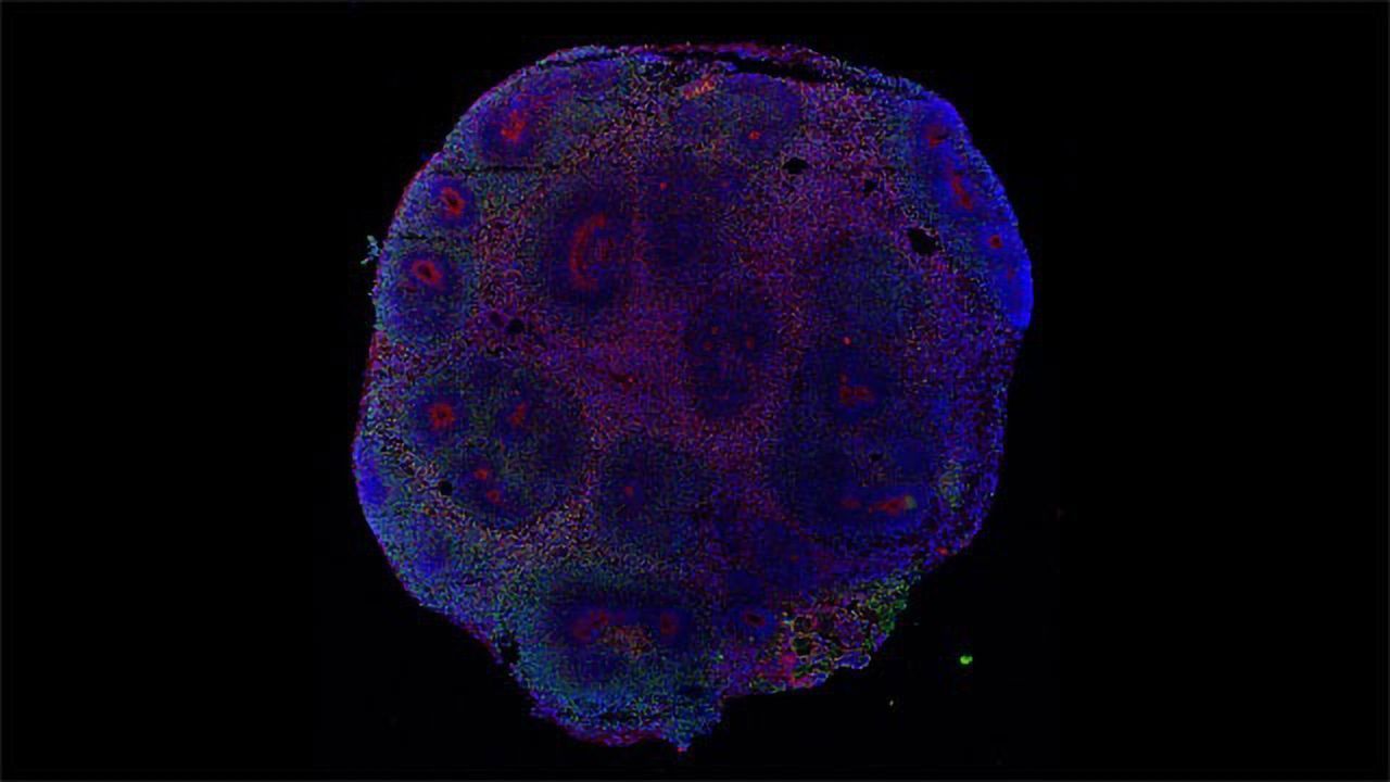 Brain Organoid Infected by the Zika Virus