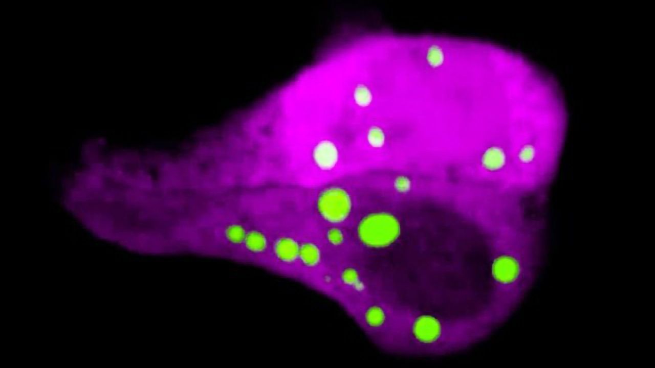 How Skin Cells Embark on a Swift Yet Elaborate Death