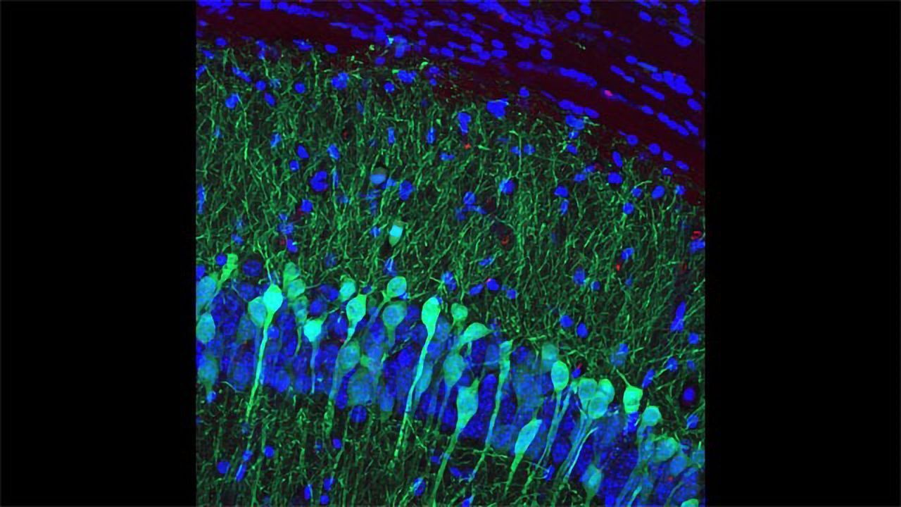 The Hippocampus and Memory