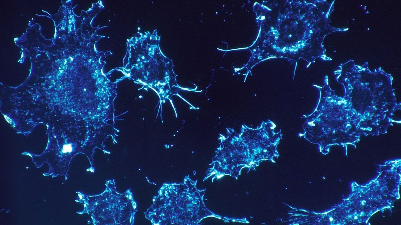 Changes in Cellular Degradation Hubs Can Lead to Cancer