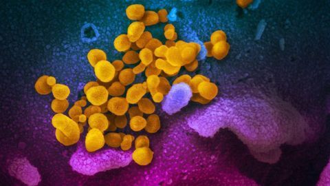 Coronavirus Stable on Surfaces for Hours to Days