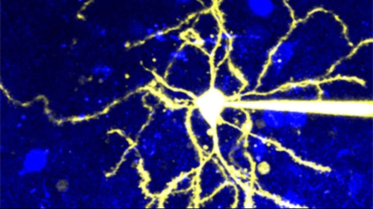 A New Window Into Psychosis