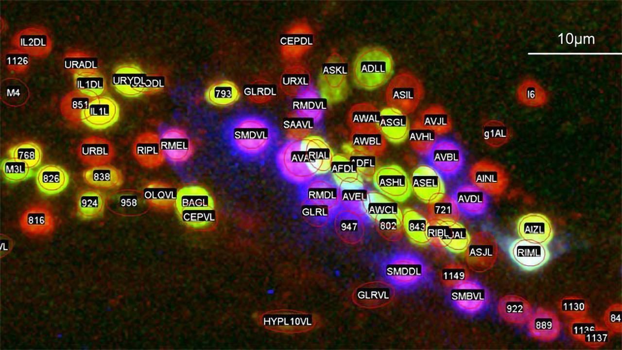 Mapping Worm Nervous Systems Just Got a Bit Easier