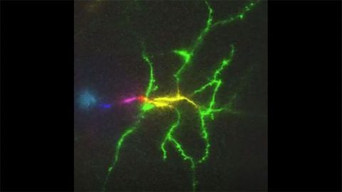 Microscope Can Image a Mouse Brain 1,000 Times a Second