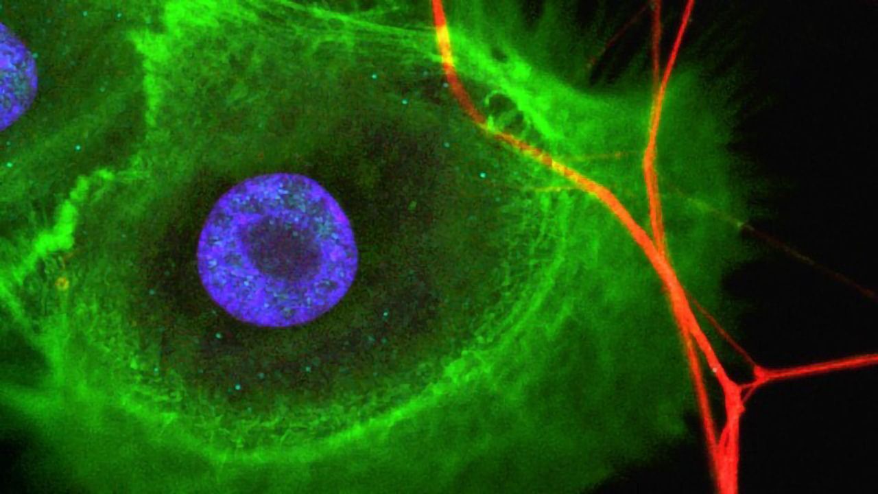 Stem Cells and Nerves Interact in Tissue Regeneration and Cancer Progression