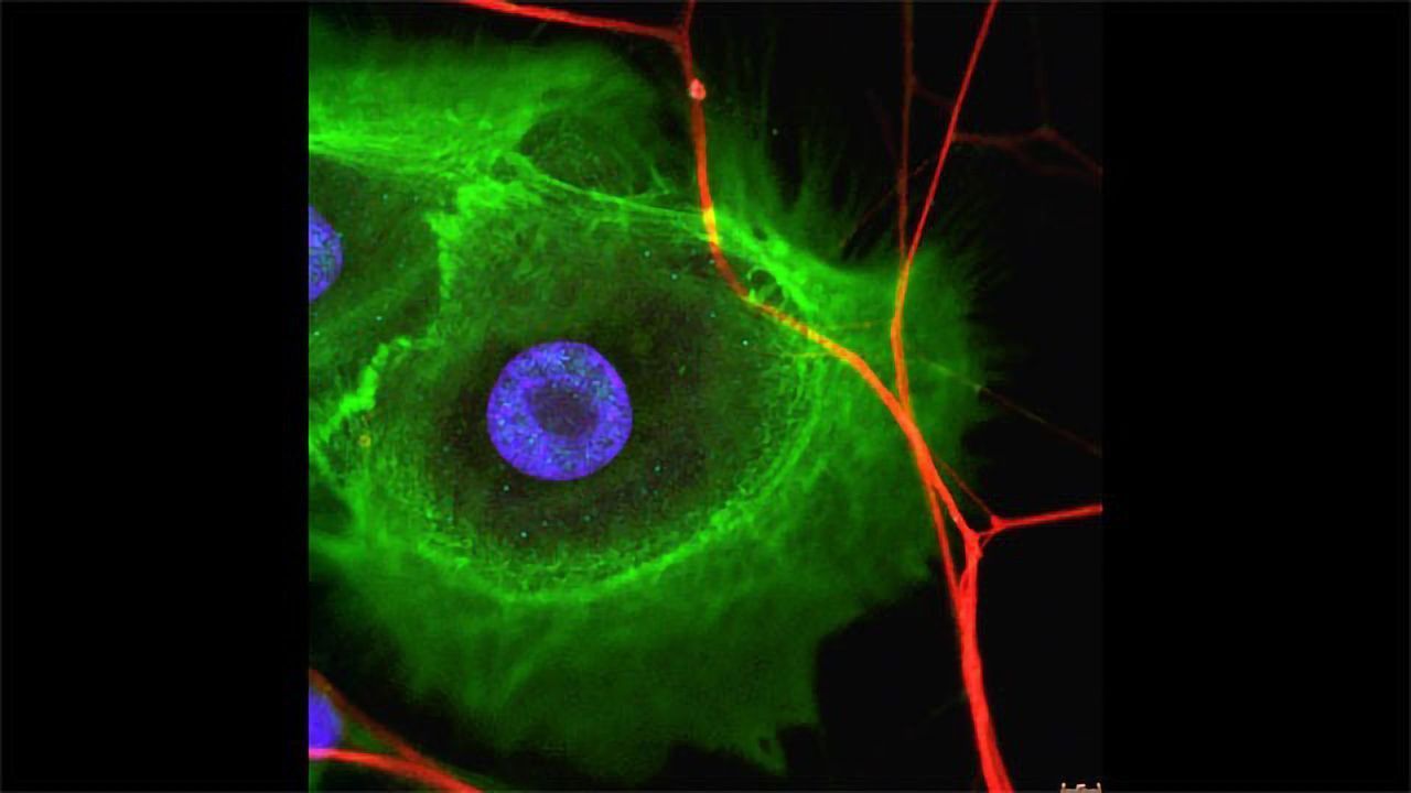 Tumor Innervation