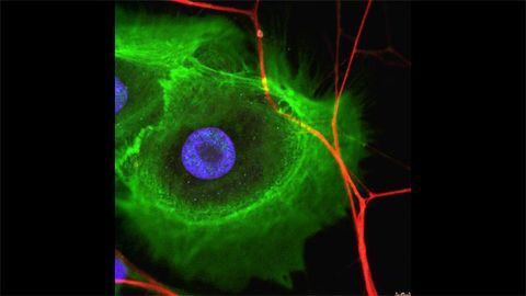 Tumor Innervation