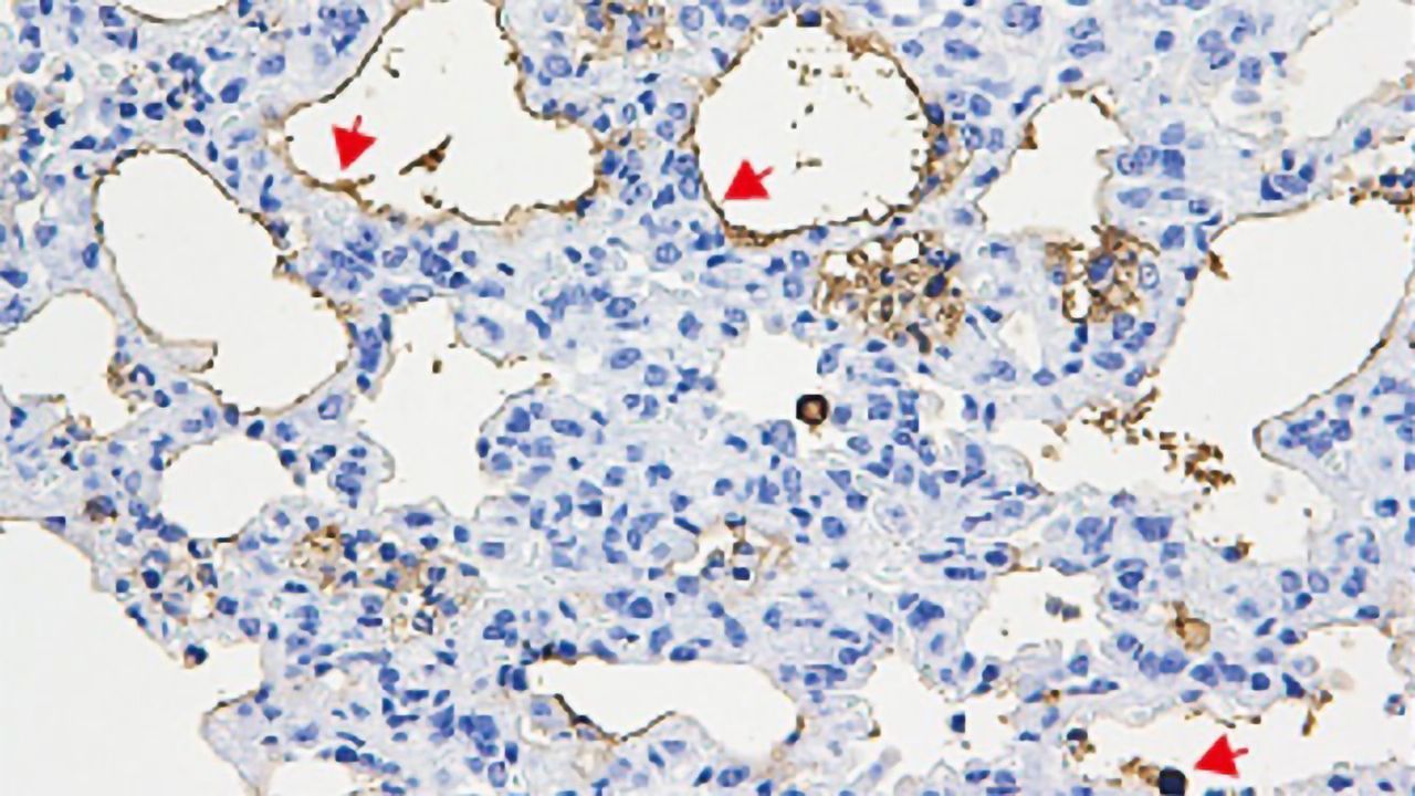 Lung Cells Killed by Bacterial Protein Fragments