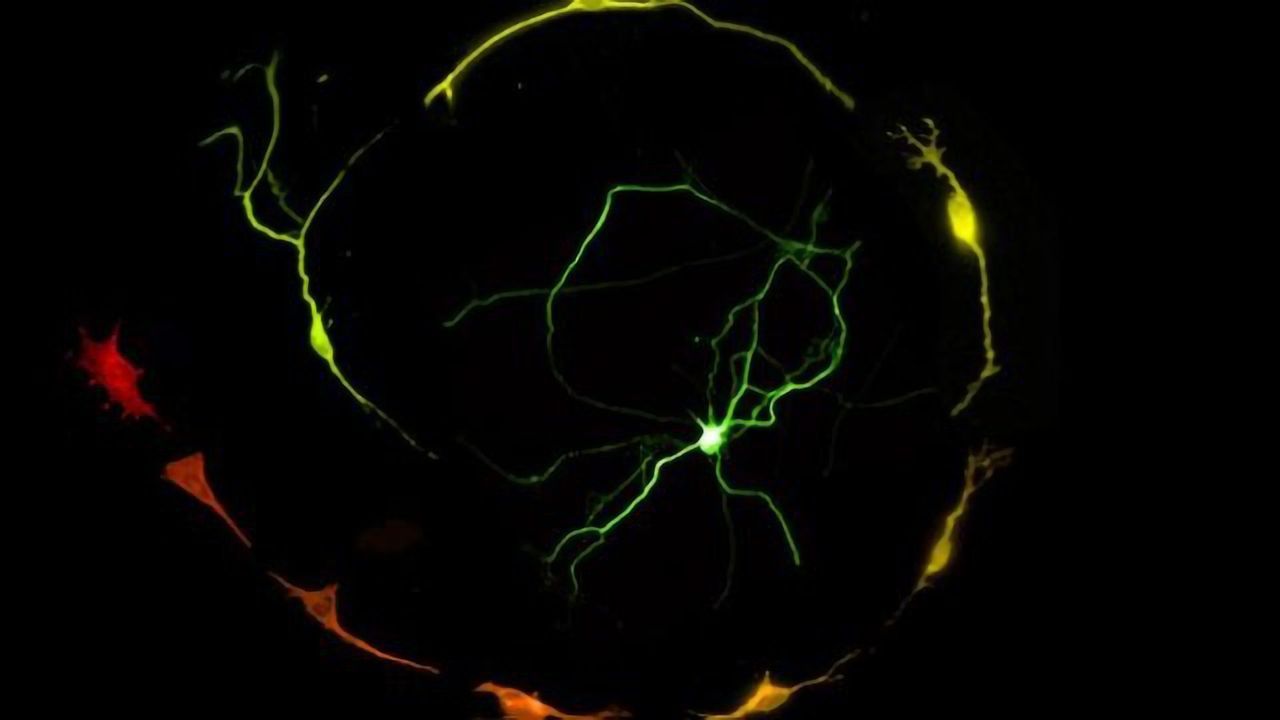 Jumping Genes Help Make Neurons in a Lab Dish
