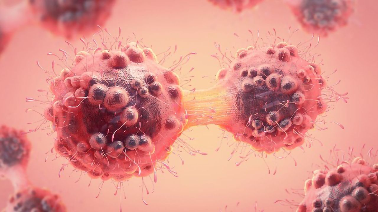 Histone Deacetylase May Be a Novel Therapeutic Strategy for Lung Cancer