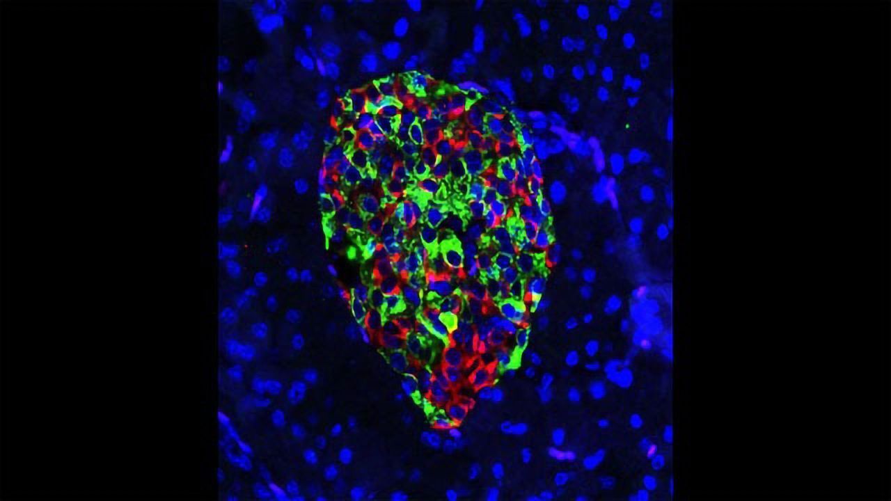 Gene-edited Pancreatic Beta Cells
