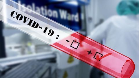 Luminex Receives FDA Emergency Use Authorization for COVID-19 Diagnostic Panel