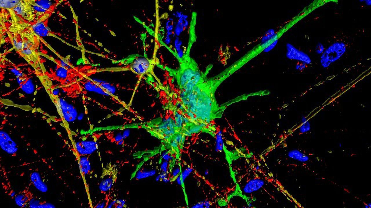 Neuron Model Helps Study How HIV Affects the Brain