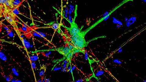 Neuron Model Helps Study How HIV Affects the Brain
