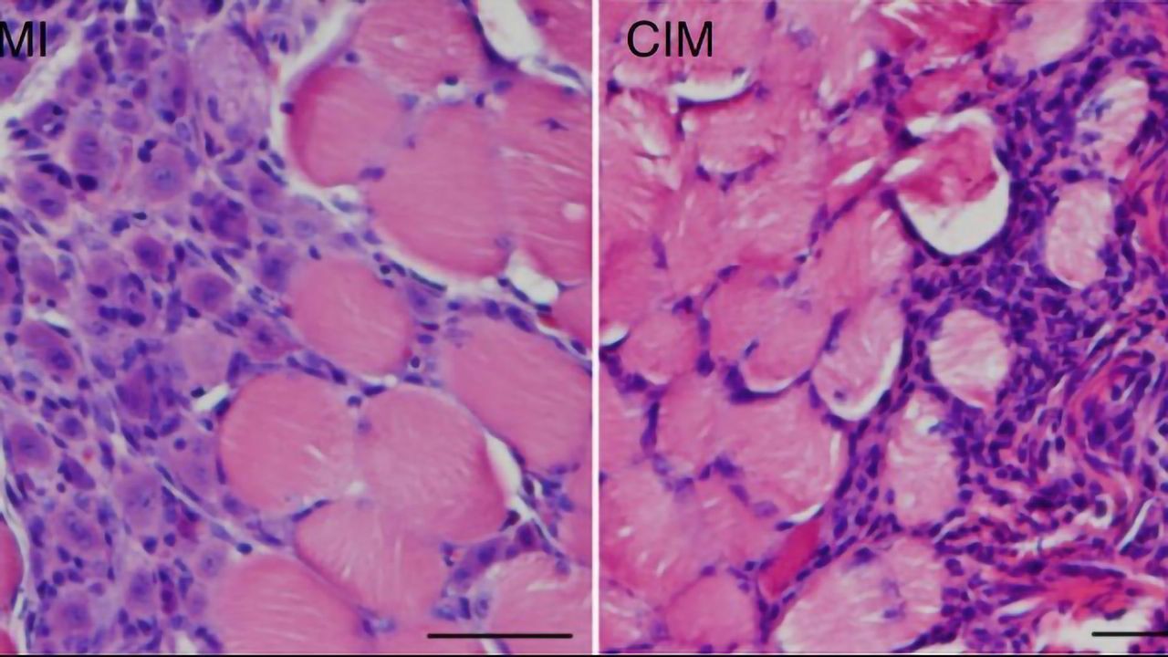 Cells Must Age for Muscles To Regenerate in Muscle-degenerating Diseases