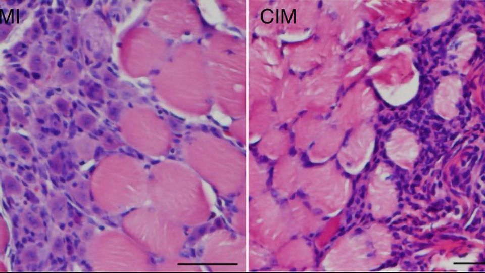 Cells Must Age for Muscles To Regenerate in Muscle-degenerating Diseases content piece image