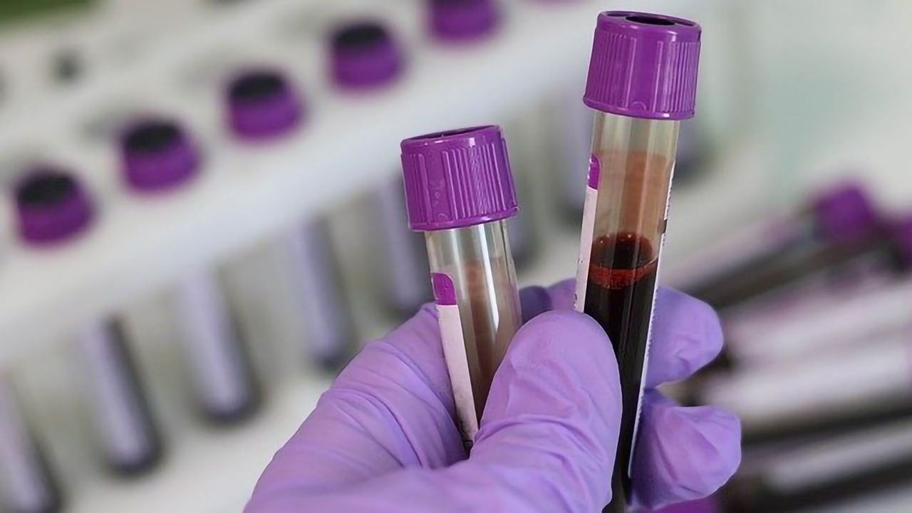 New Biomarker in Blood Could Lead to Early Alzheimer's Disease Test