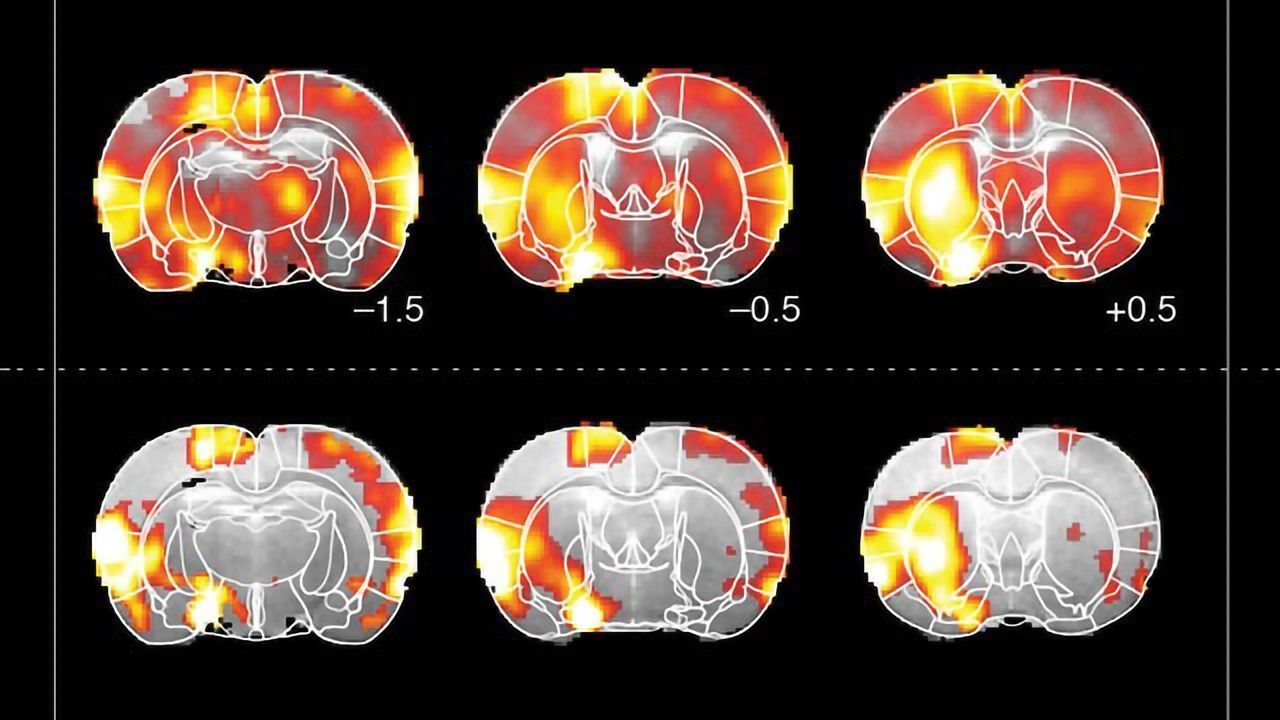 How Dopamine Drives Brain Activity