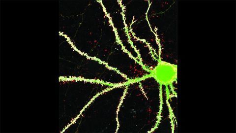 Study Offers Clues to Why Autism Is More Common in Boys