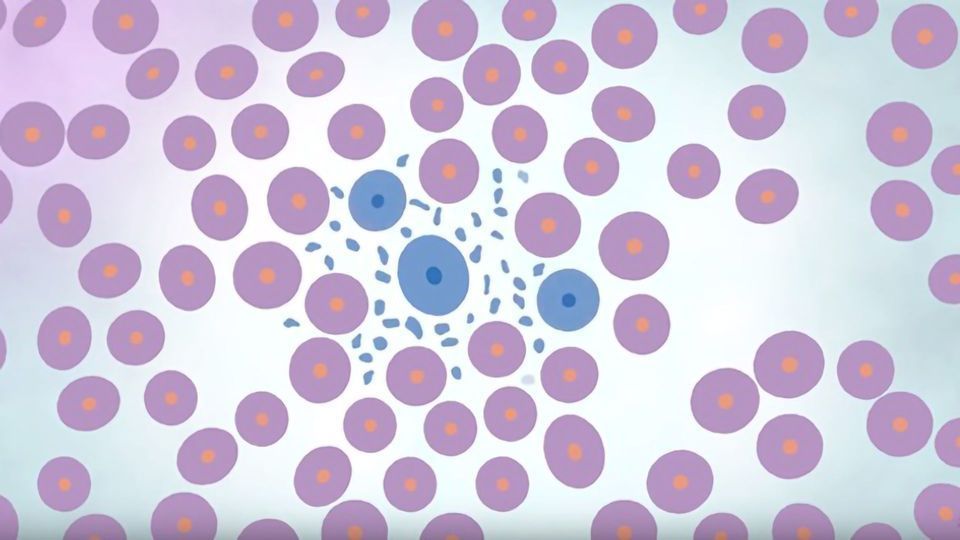 What Is Philadelphia Positive Leukemia? content piece image