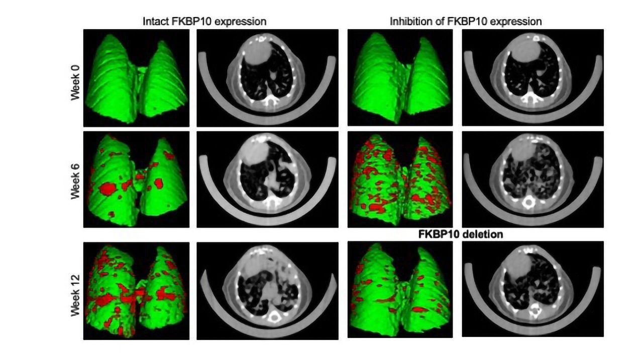 A New Molecular Target for Especially Aggressive Cancers